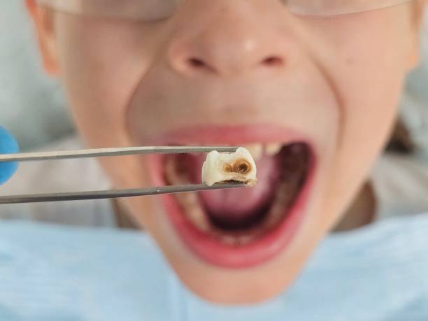 Best Emergency Broken Tooth Repair in South Shore, KY