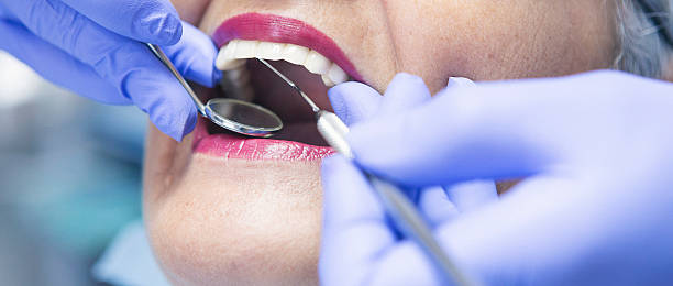 Best Emergency Tooth Extraction in South Shore, KY